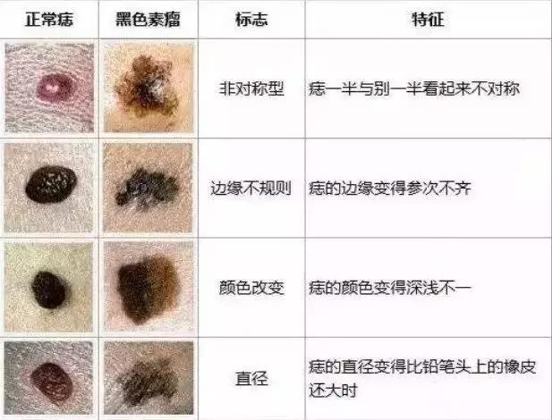 医院里点痣价格解析