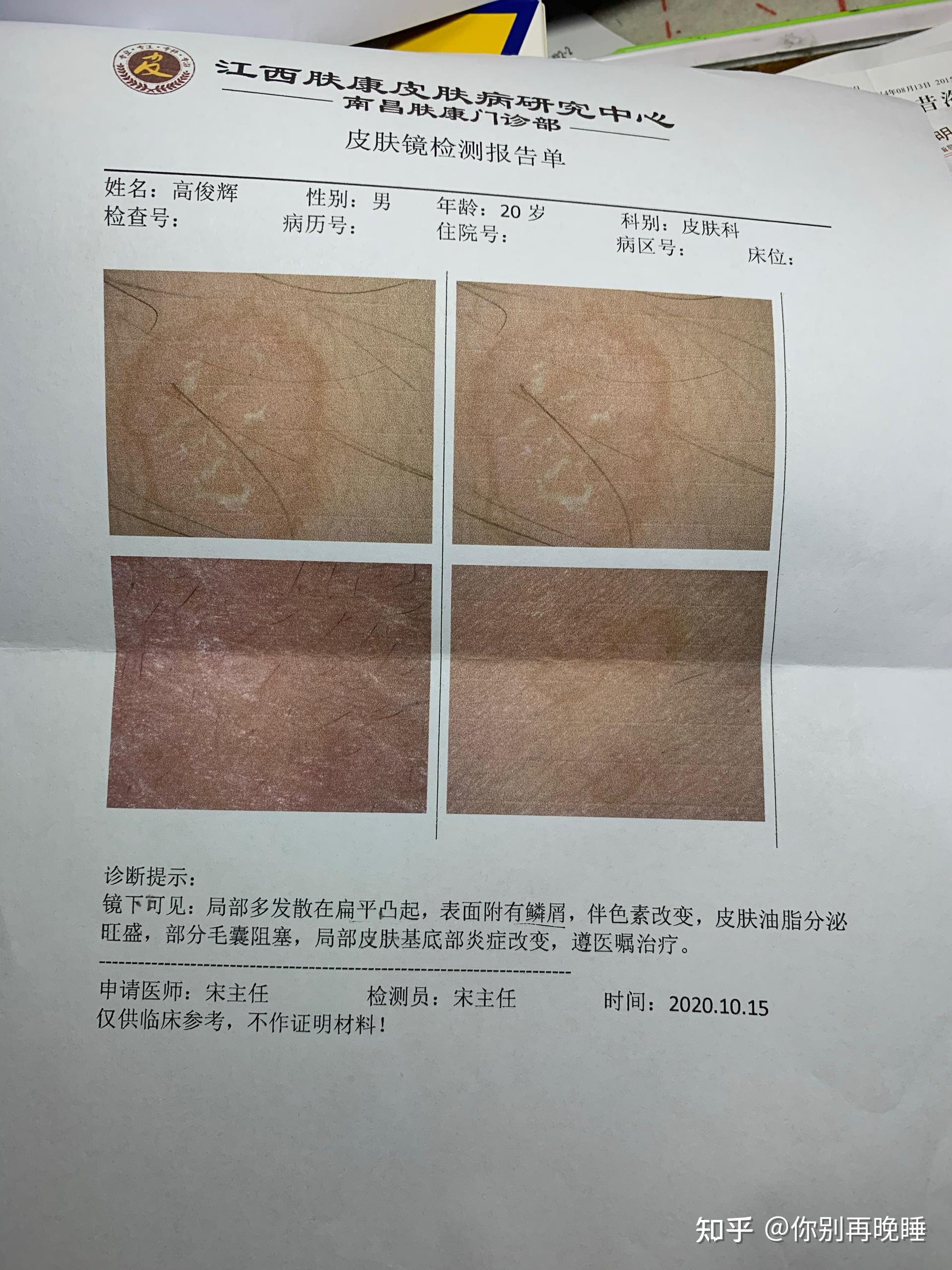 医院激光去疣价格解析