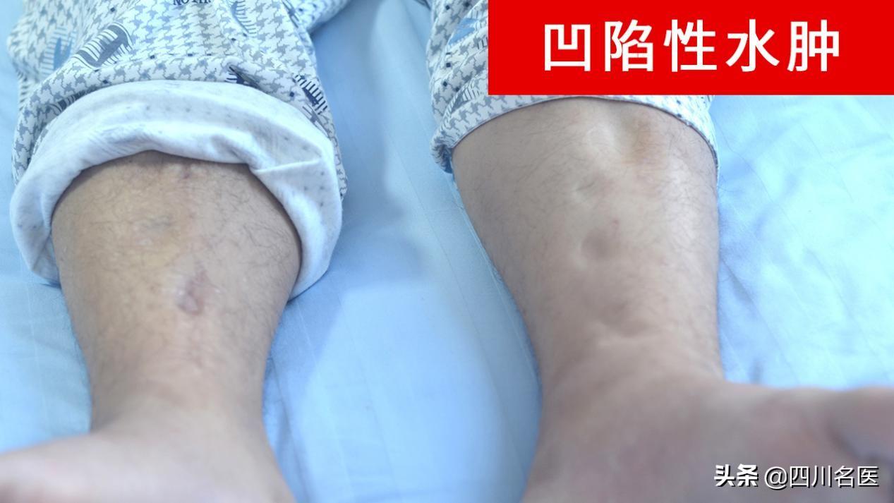 医院的WIFI密码一般是多少？