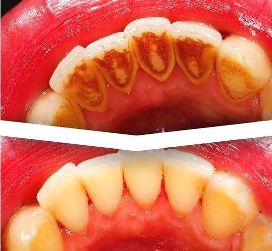 口腔健康新起点，了解洗牙应挂的科室