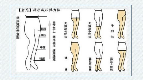 简单有效的静脉曲张治疗法，每日坚持，迈向康复之路
