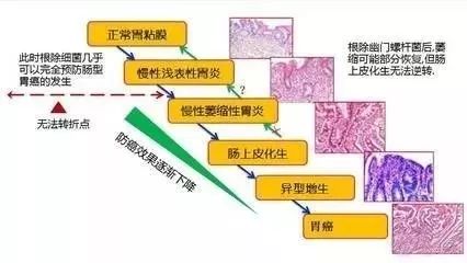 萎缩性胃炎的全面治疗方案，从诊断到康复的全程指南