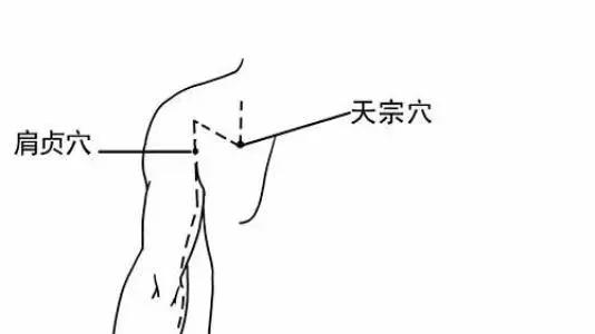 穴位疗法，解锁颈椎健康的自然钥匙