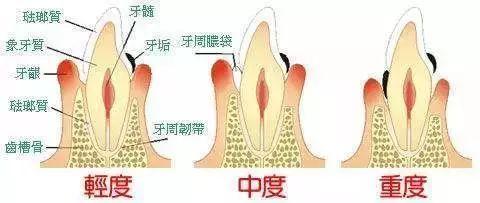 口腔医院分级，从基础到专业，守护您的口腔健康